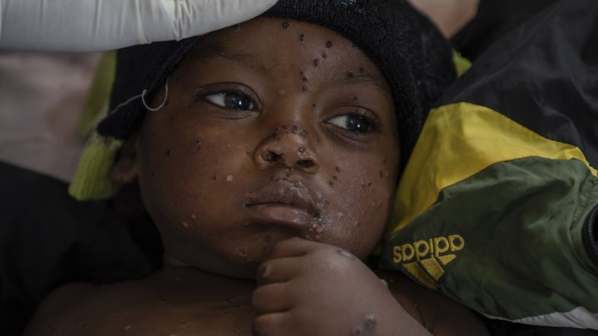 Mpox cases in Congo may be stabilizing. Experts say more vaccines are needed to stamp out virus