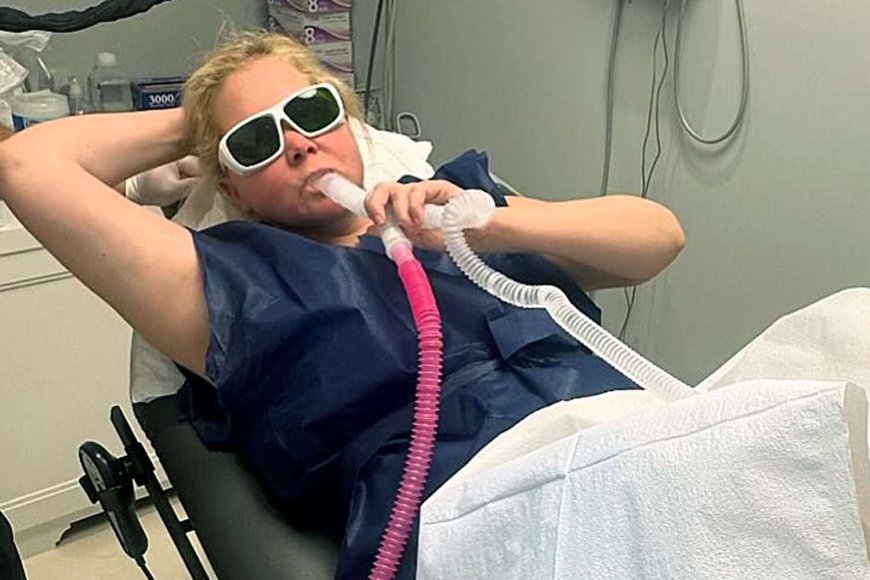 Amy Schumer Posts Photo from Gynecologist's Office with Her Feet in Stirrups: 'I'm Fine'