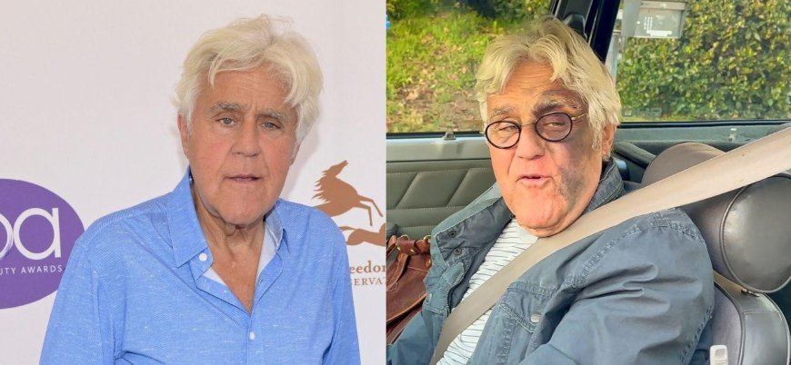 Jay Leno Reveals He's 'Feeling Good' Despite Suffering Facial Bruises After Nasty Fall From A Hill