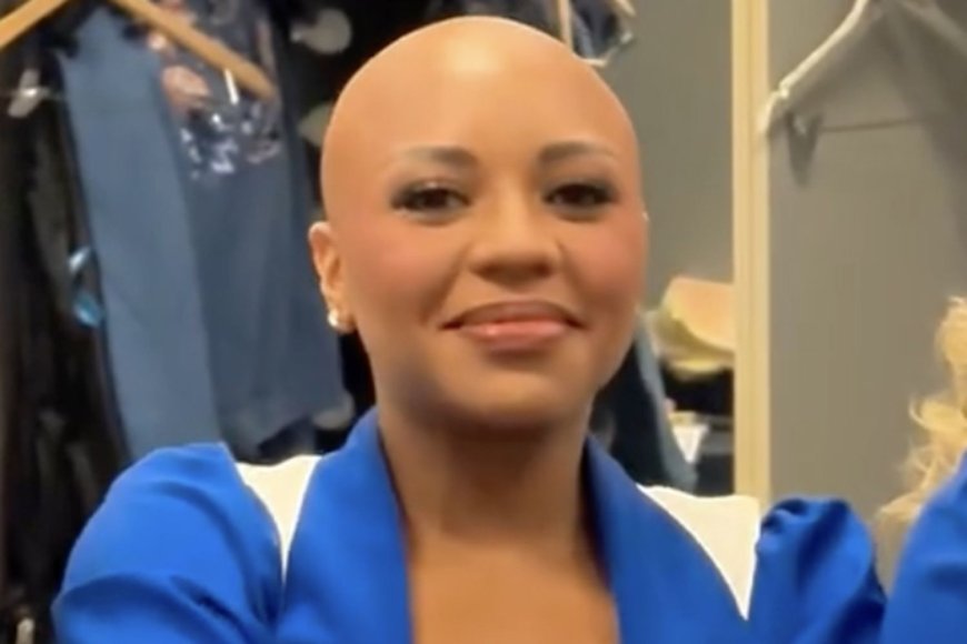 “Dallas Cowboys Cheerleaders ”Star Armani Latimer Dances Without Wig for First Time Since Revealing Her Alopecia on Show