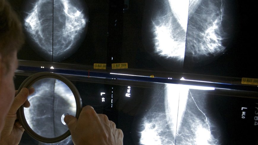 Some breast cancer patients can avoid certain surgeries, studies suggest