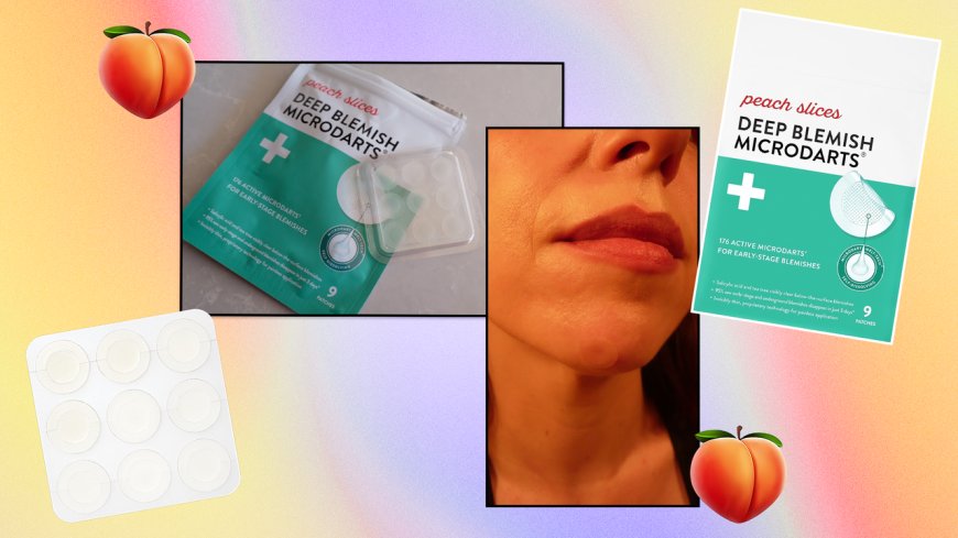 Peach Slices Deep Blemish Microdarts Review: My Favorite Pimple Patches