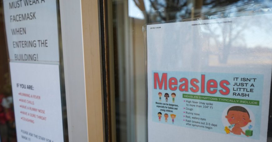 As Measles Cases Mount in the U.S., What’s the Situation Worldwide?